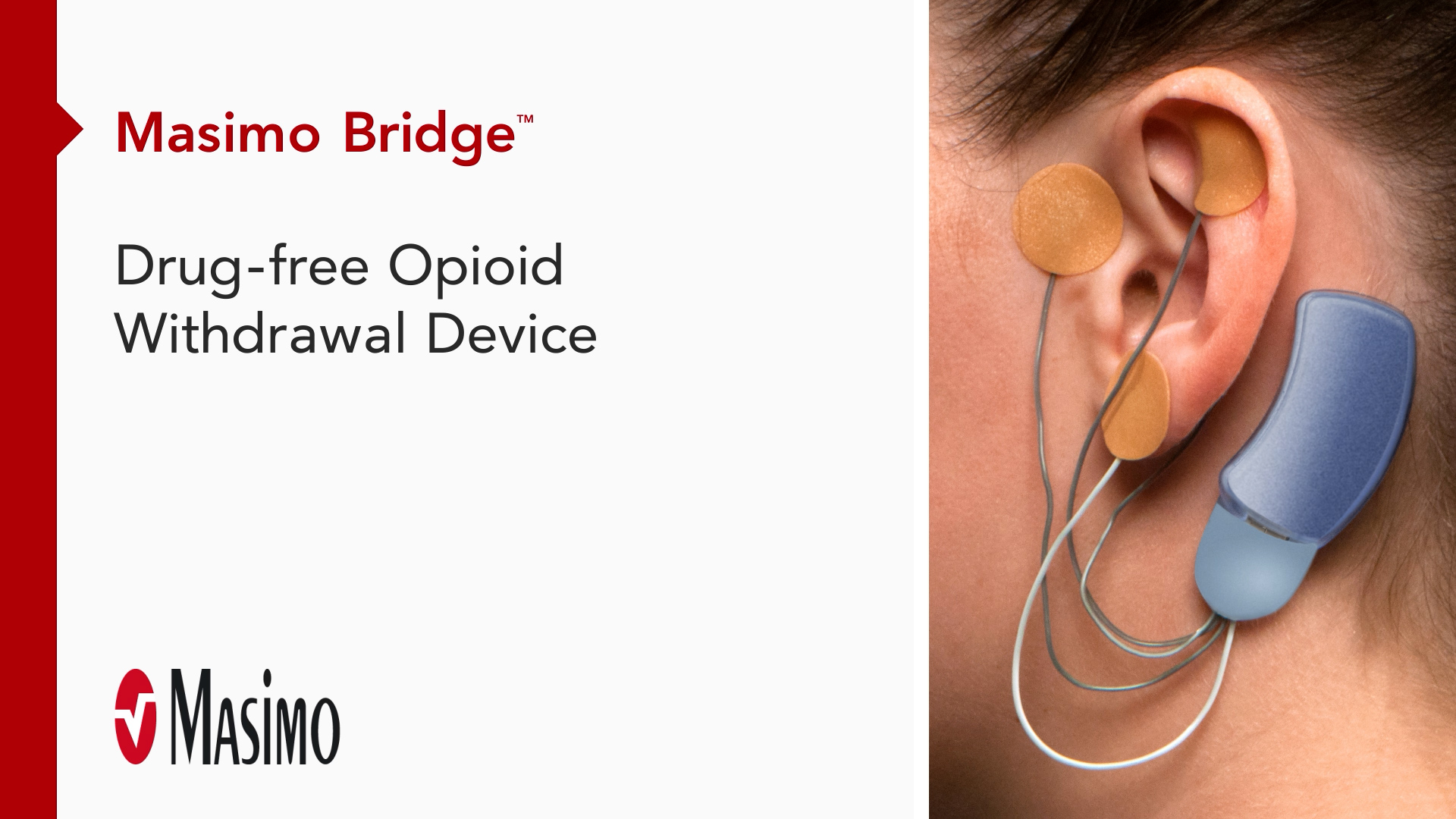 Overview: Masimo Bridge Drug-free Opioid Withdrawal Device