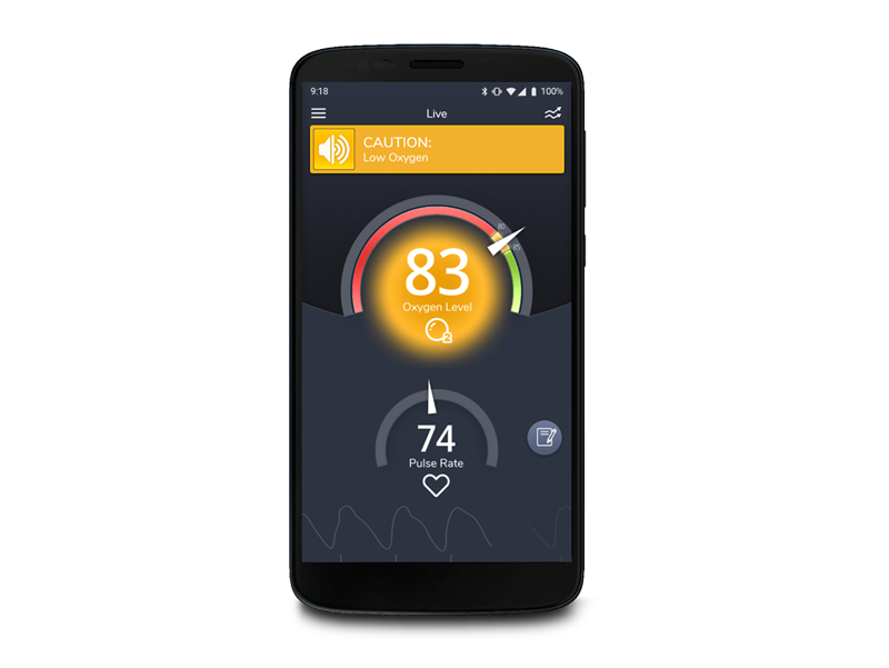 Masimo SafetyNet Alert app showing caution screen