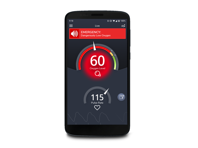 Masimo SafetyNet Alert app showing emergency screen