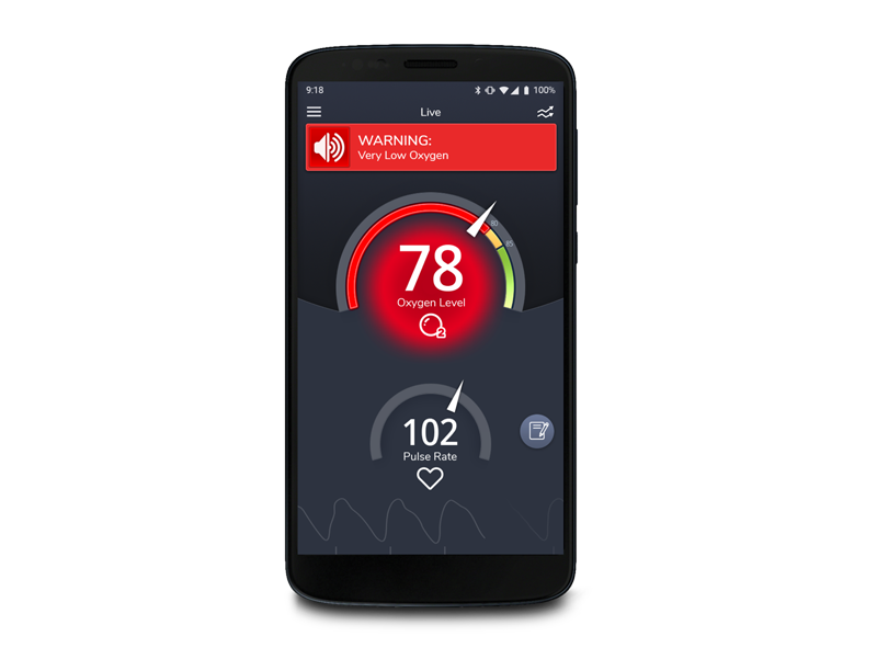 Masimo SafetyNet Alert app showing warning screen