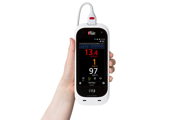 Masimo - Rad-67 Spot-check Pulse CO-Oximeter