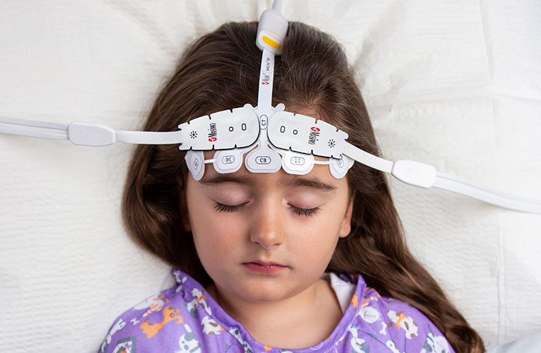Masimo - ICU SedLine Root 