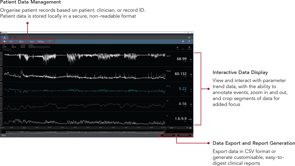 Masimo - Trace - Data Display