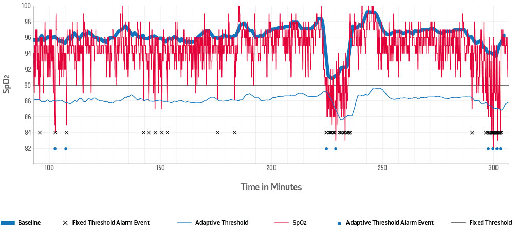 Masimo - Actionable alarm notification 