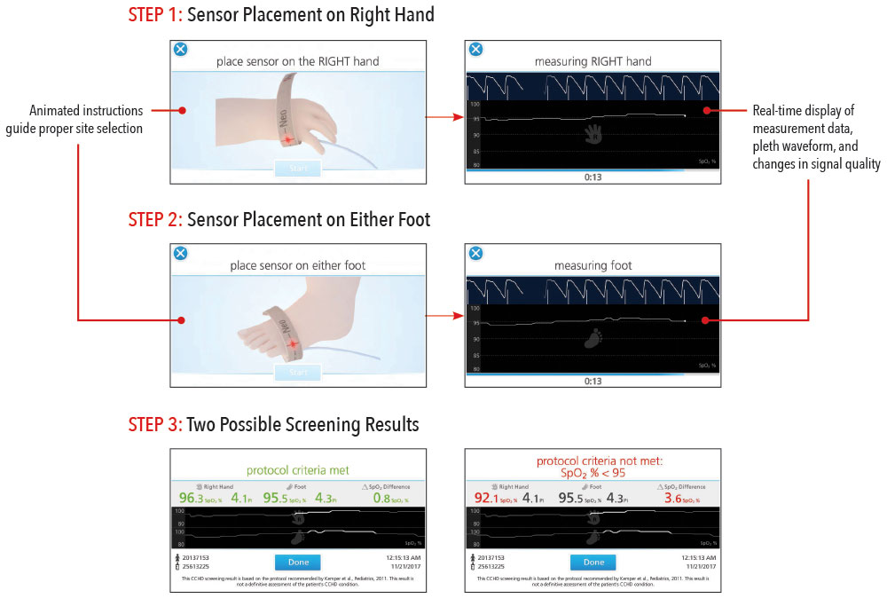 Masimo - Eve Step-By-Step Instruction Improves Consistency and Workflow Efficiency