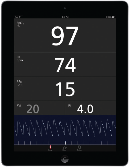 Masimo - Measurements shown on Masimo Professional Health App