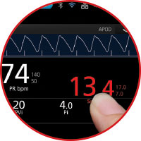 Masimo - Rad-97 Capnography customizable display