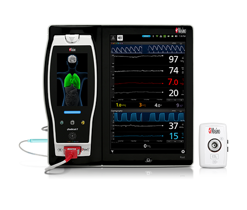 Masimo - Root with NomoLine Capnography