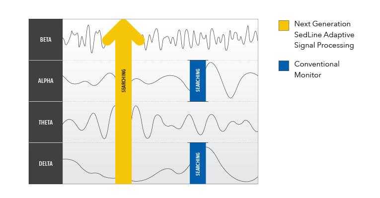 Masimo - Traitement du signal adaptatif avec des caractéristiques indépendantes des bandes de fréquences