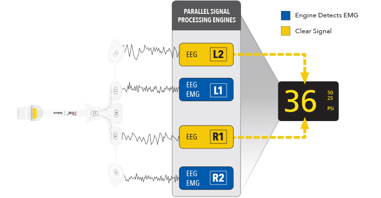Masimo - Parallel Signal Processing Engines