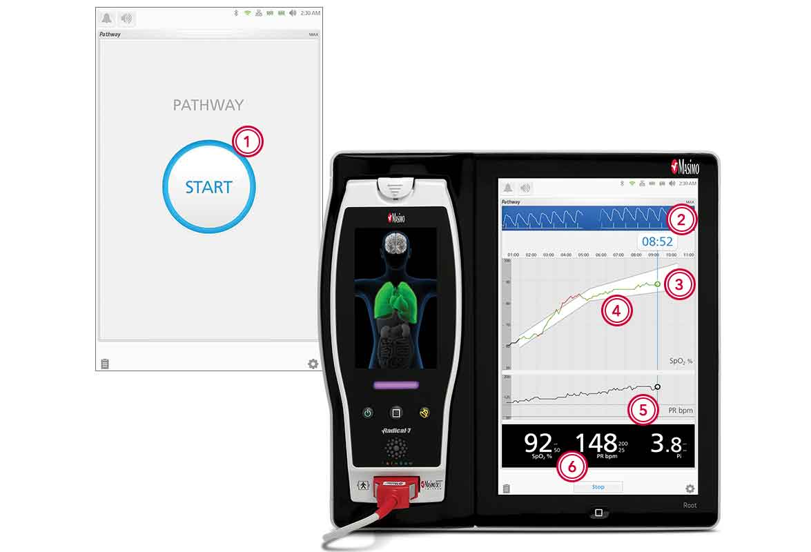 Masimo - Screen of Start button and device