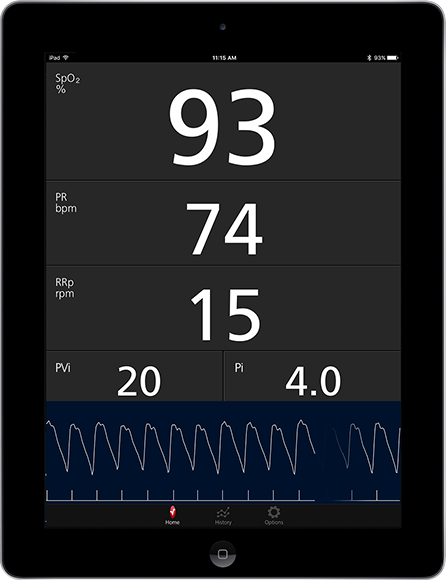 Masimo – Mesures affichées à l’aide de l’application Masimo Professional Health