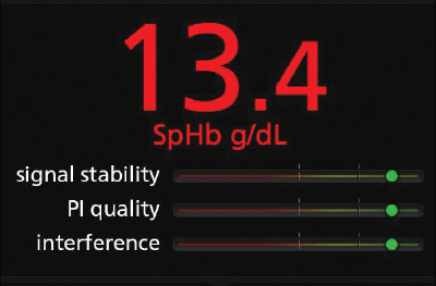 Masimo - Rad-67 - Display spot-check results