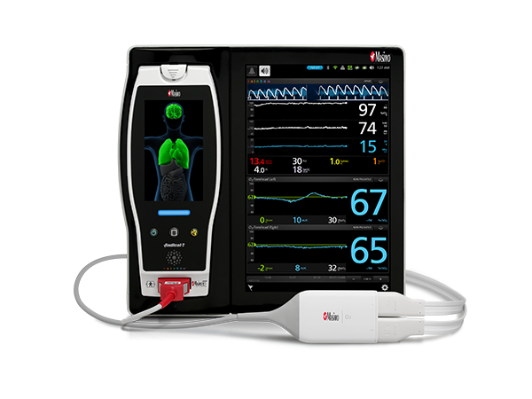 Masimo - Root® with O3® Regional Oximetry